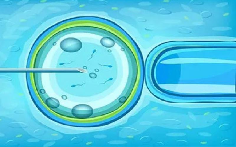 睾丸静脉曲张手术费用代生